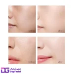 پک نخ کلاژن ساز جذبی طلا HIH