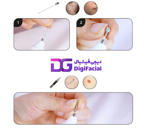 دستگاه بیوتی پن 9 قدرته 2 چراغ