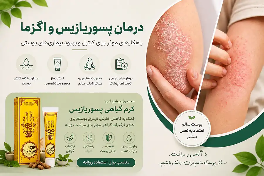 استفاده از کرم طب سنتی درمان پسوریازیس و اگزما