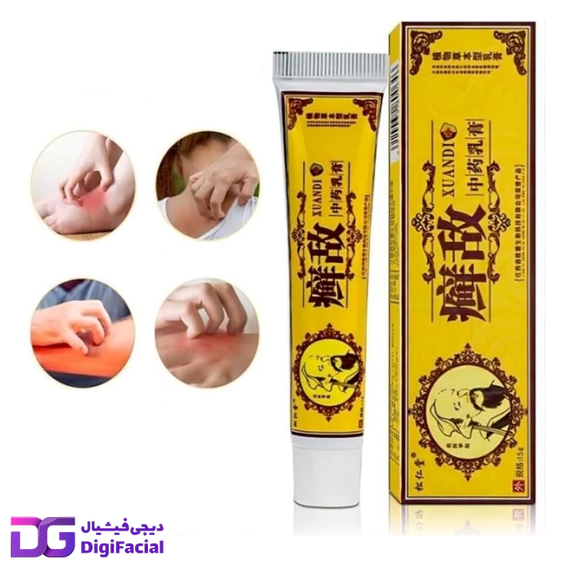 خرید کرم طب سنتی درمان پسوریازیس و اگزما XUANDI